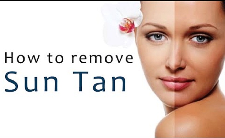 How To Remove Sun Tan Quickly With Home Remedies 2481