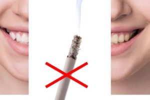 tobacco effects on teeth